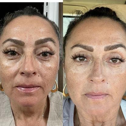 Nadia R., 53 anni