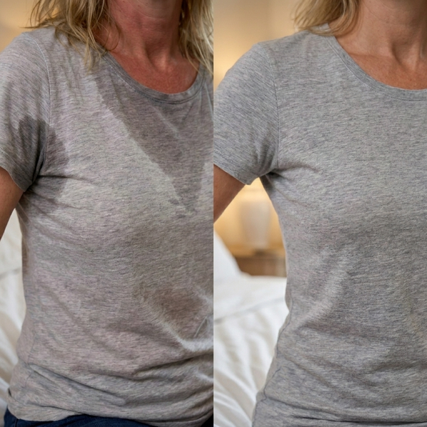 Daniela H., 56 anni